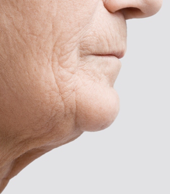 Skin Care Tips for Aging Skin